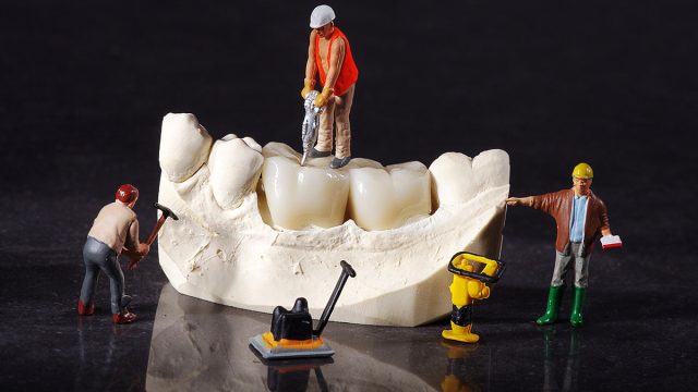 Dental Implant vs. Fixed Bridge: Restoring Missing Teeth