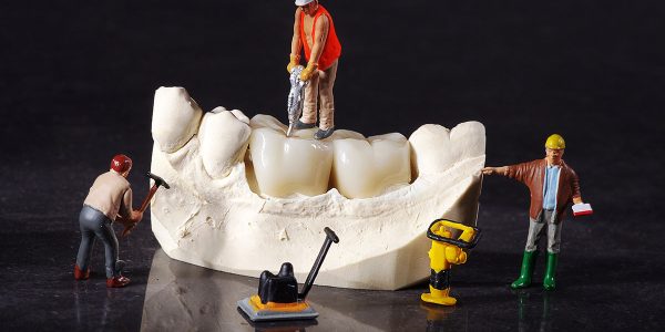 Dental Implant vs. Fixed Bridge: Restoring Missing Teeth