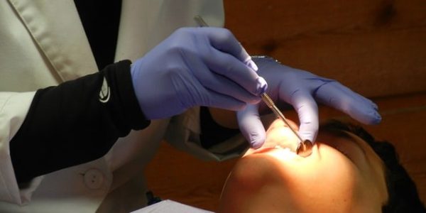Dental Filling Operations Your Dentist in San Marcos Can Perform