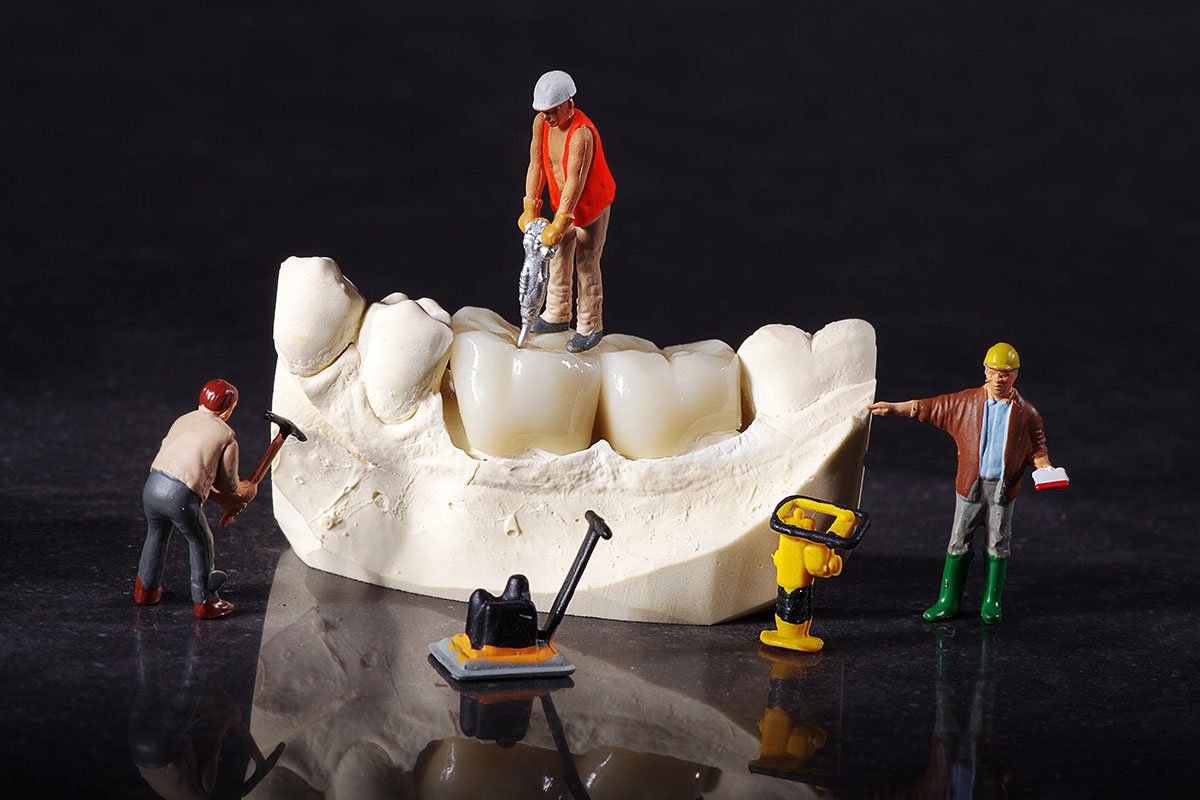 Miniature construction worker figurines staged around a dental cast model of teeth as if working on a job site.