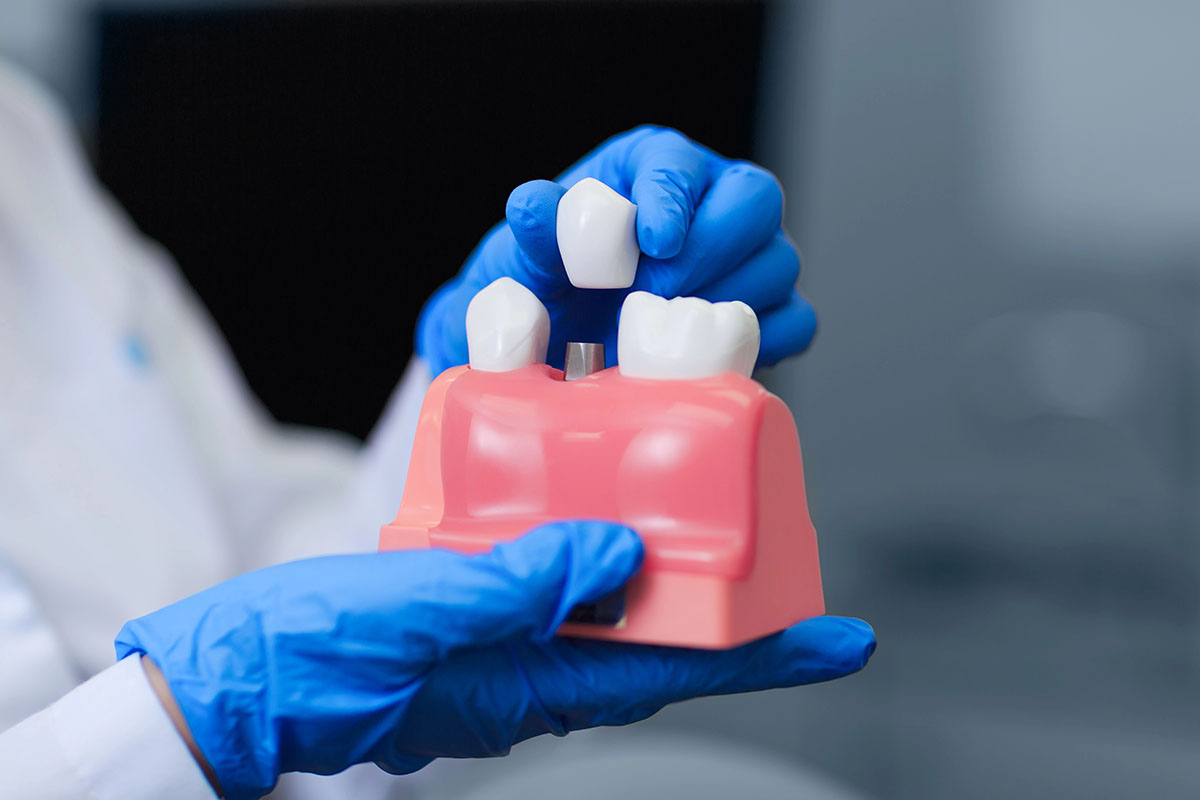 A dentist holding a model of a San Marcos dental implant.